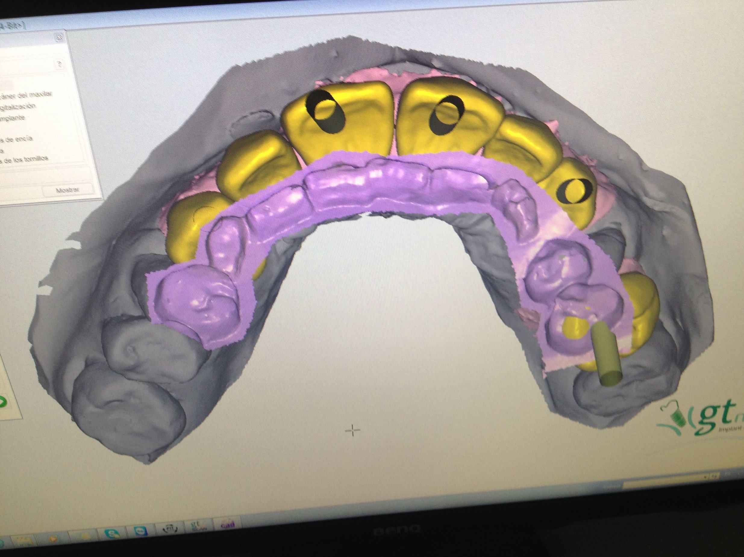 cad cam